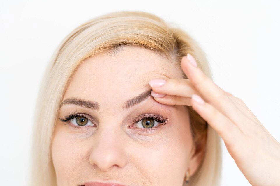 Eyelid-Surgery