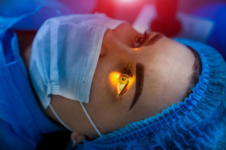 PRK-Eye-Surgery