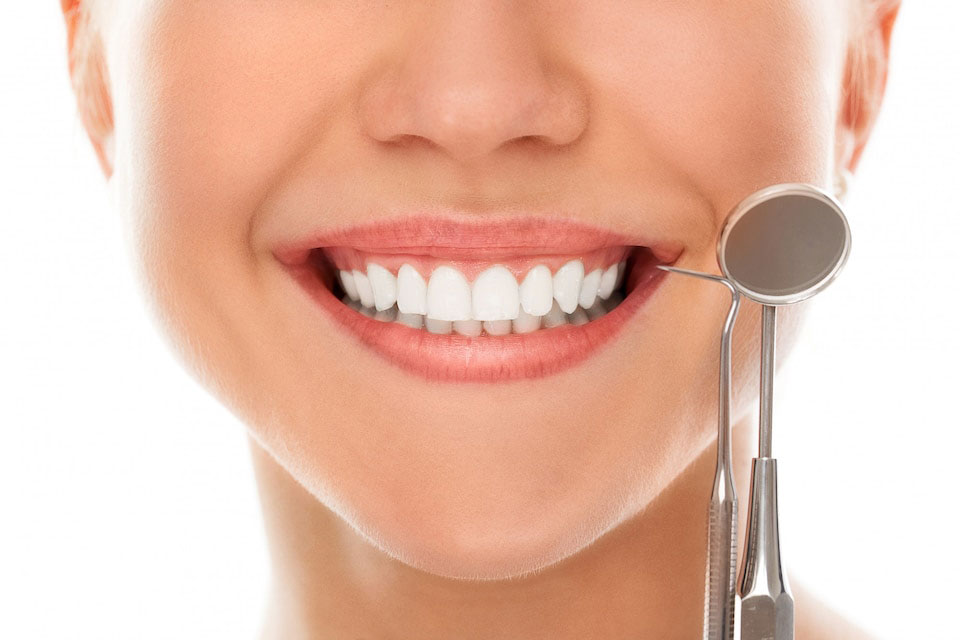 e-max-veneers